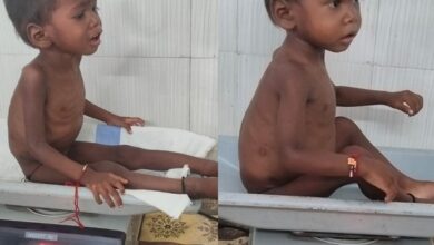 From Malnutrition to a Happy Childhood: A Convergence of Treatment and Awareness at the Nutrition Rehabilitation Centre