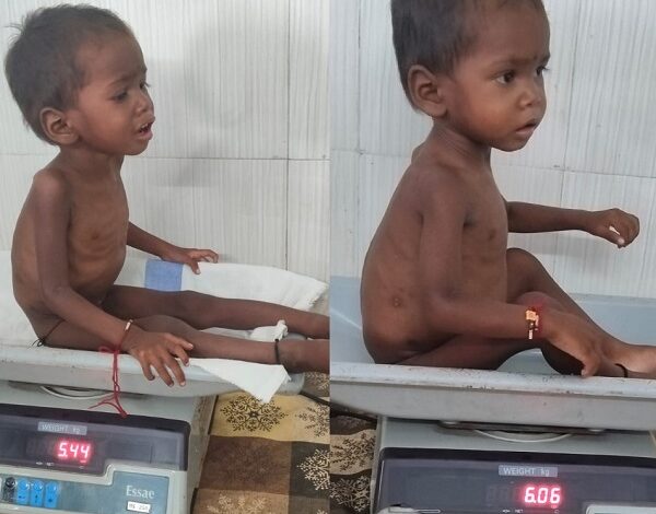 From Malnutrition to a Happy Childhood: A Convergence of Treatment and Awareness at the Nutrition Rehabilitation Centre